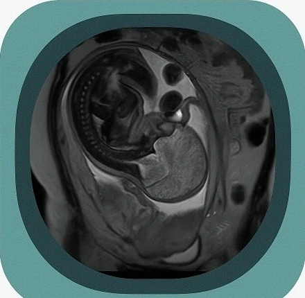fetal mri anatomy icon